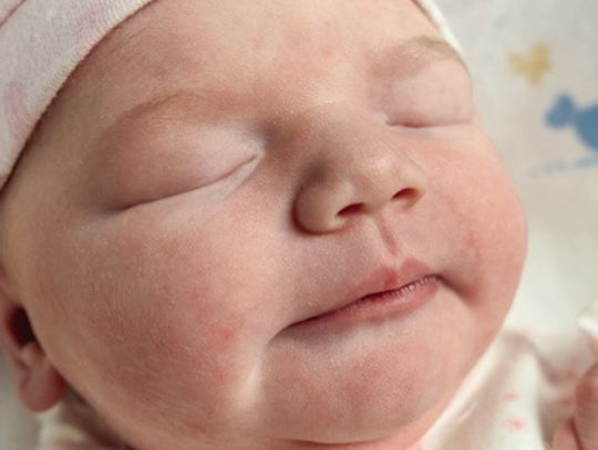 Adeline